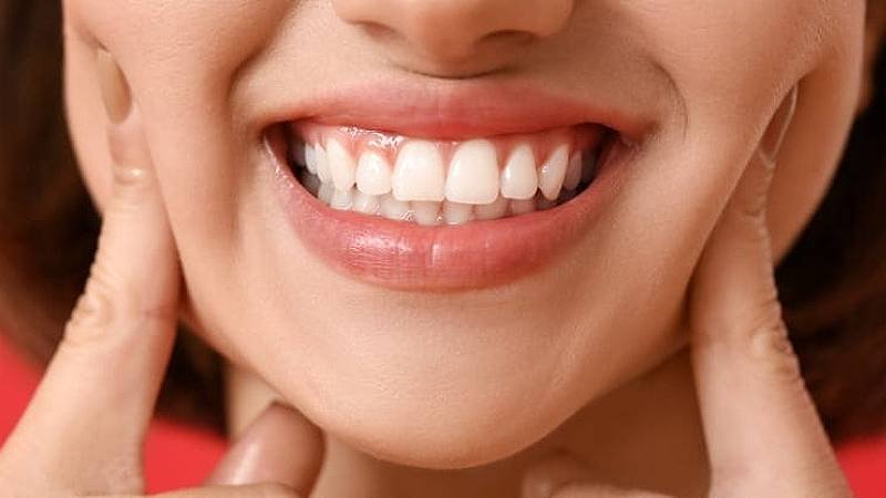 新加坡牙齿美白